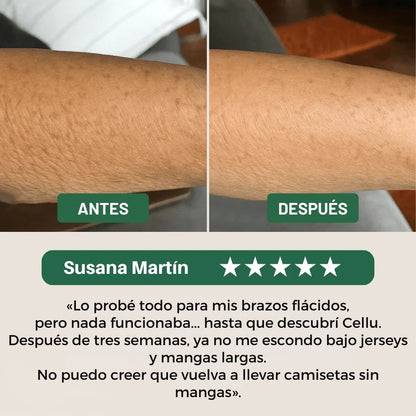 Tratamiento reparador de piel fina